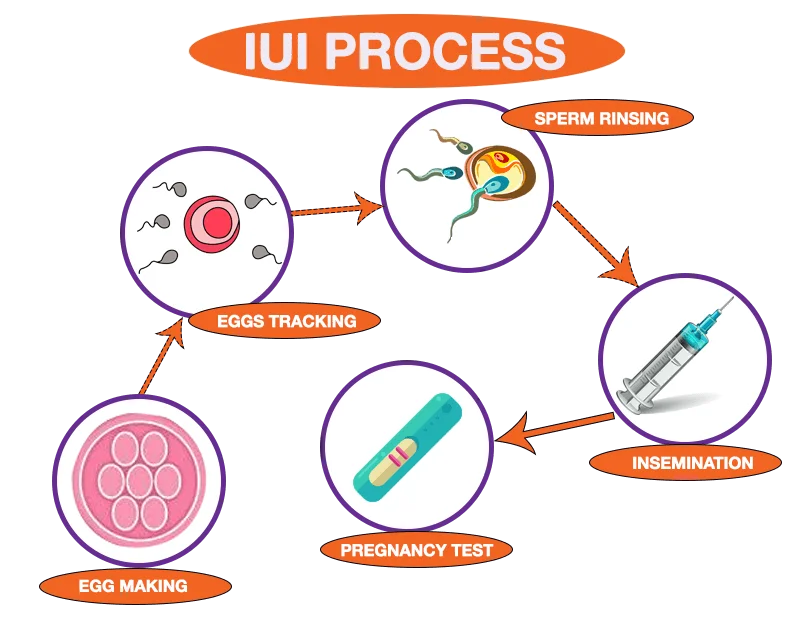 Infertility Treatment