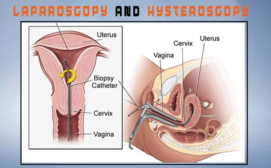 Laparoscopy and Hysteroscopy