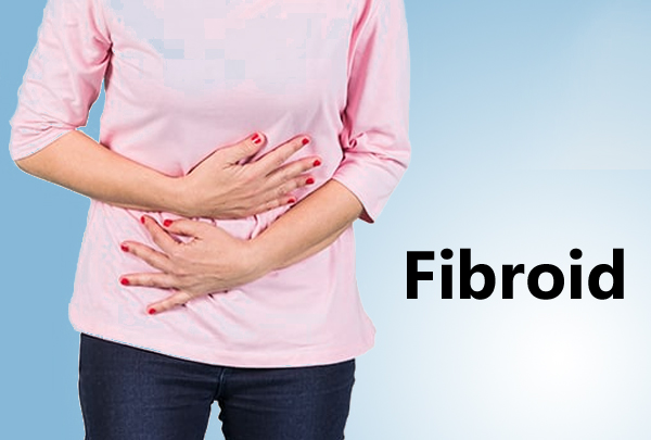 Fibroids Treatment