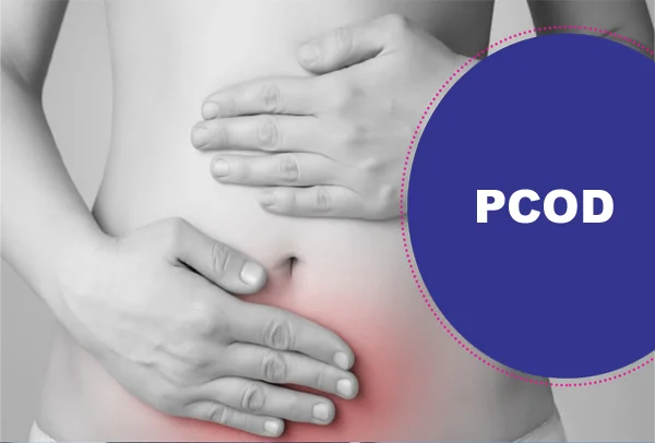 PCOD Treatment