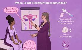 Intrauterine Insemination Treatment